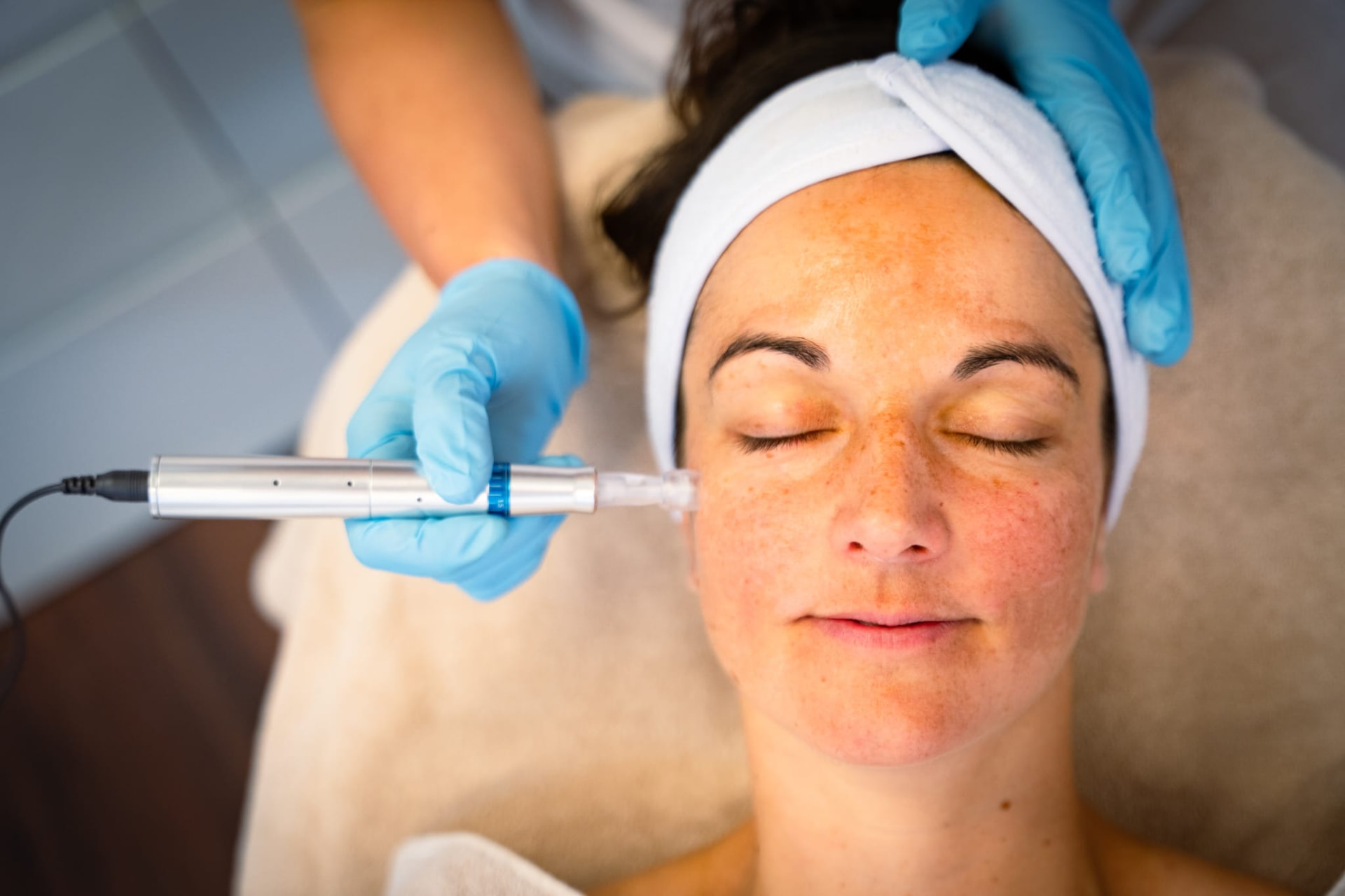 Microneedling bei Tania Filoni Cosmetic